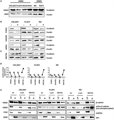 Canonical WNT/β-Catenin Signaling Plays a Subordinate Role in Rhabdomyosarcomas